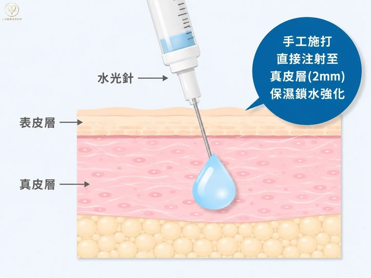 手打水光針 作用原理與常見功效