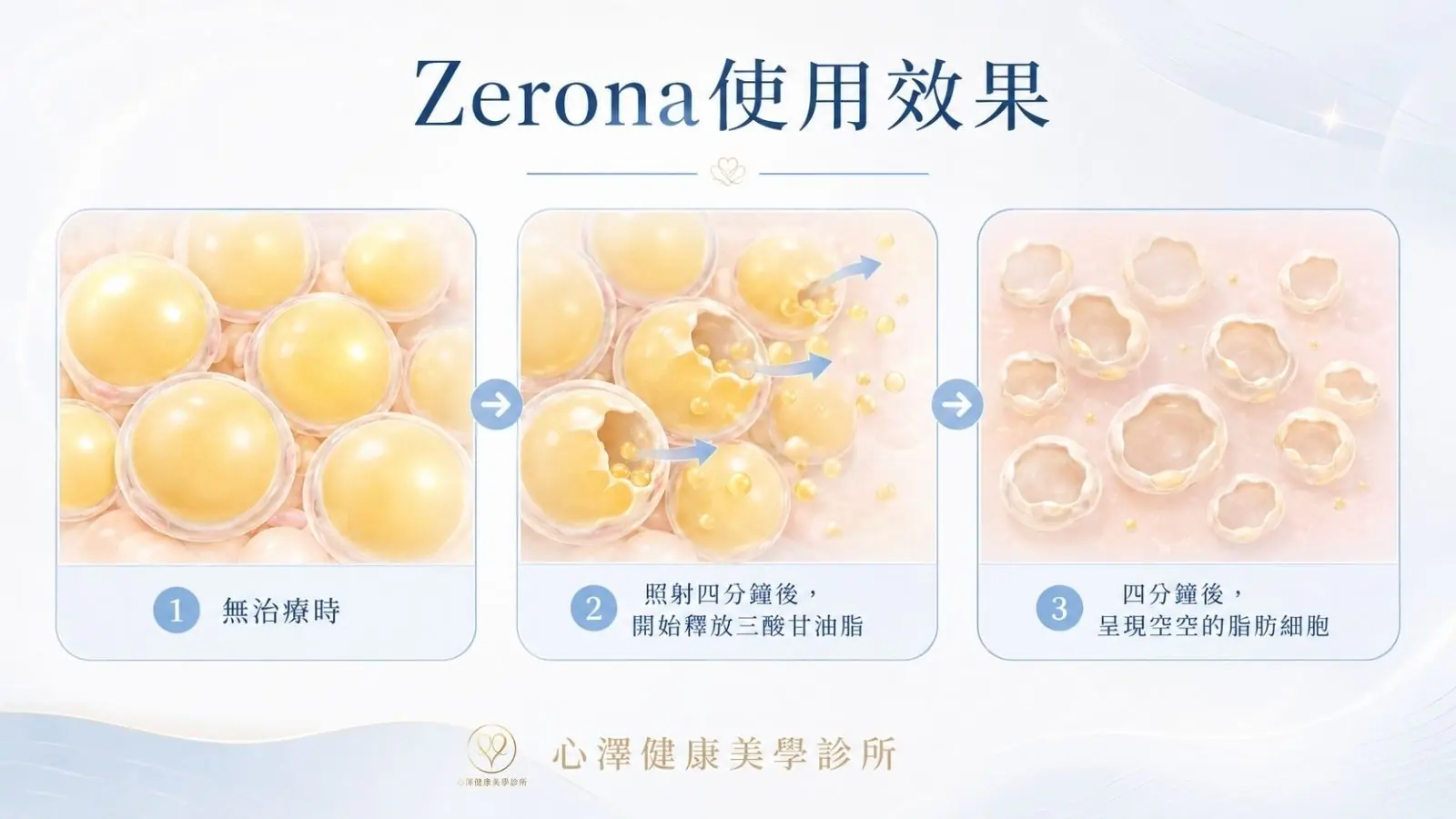 淋巴與血液循環：身體的內在代謝大掃除