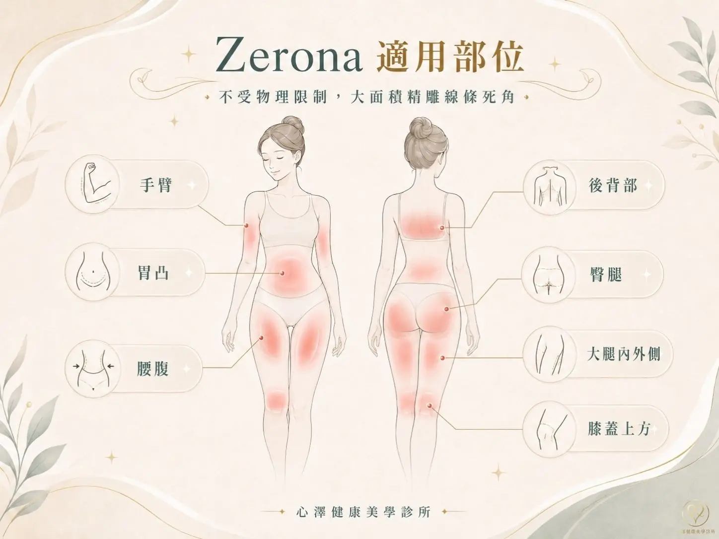 Zerona上半身精雕：手臂、胃凸、腰腹、後背部脂肪。
下半身精雕：臀腿、大腿內外側、膝蓋上方區域。