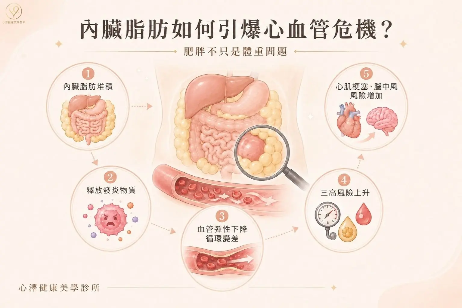 代謝症候群與「三高」危機