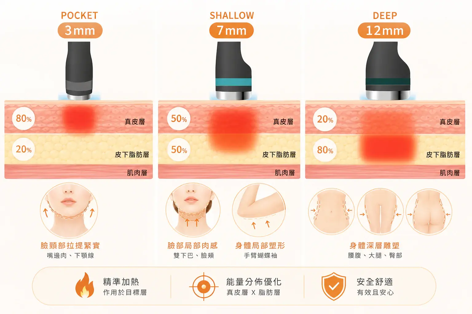 Onda Pro 超微波重塑平滑肌