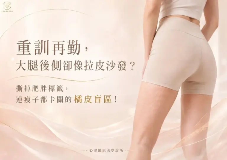 重訓再勤，大腿後側卻像拉皮沙發？撕掉肥胖標籤，連瘦子都卡關的橘皮盲區！