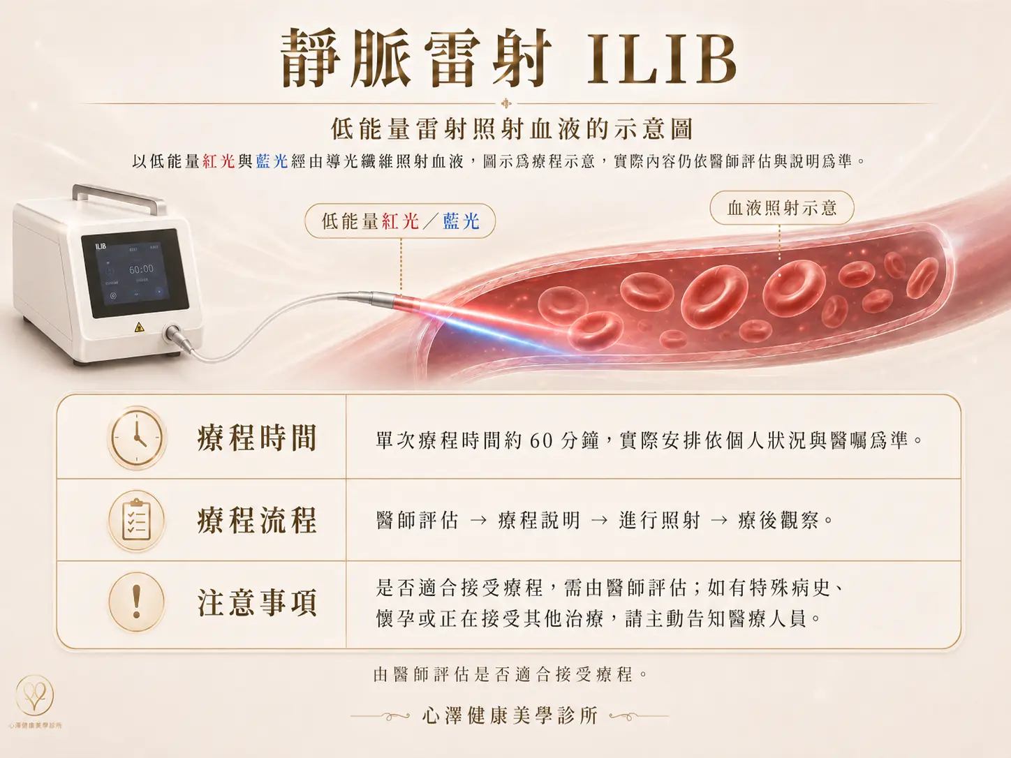 靜脈雷射不使用任何藥物,也沒有恢復期或不舒服的感受,每次療程約 60 分鐘,通常連續十次為一個療程,打完即可恢復正常生活