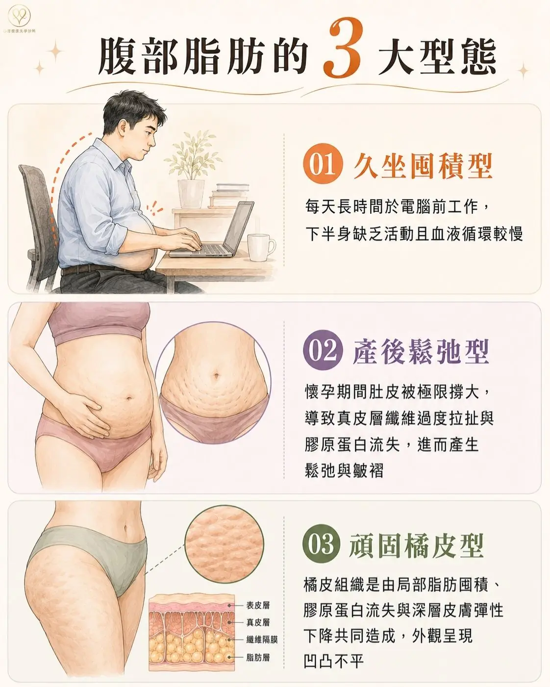 ONDA PRO腹部脂肪的 3 大型態