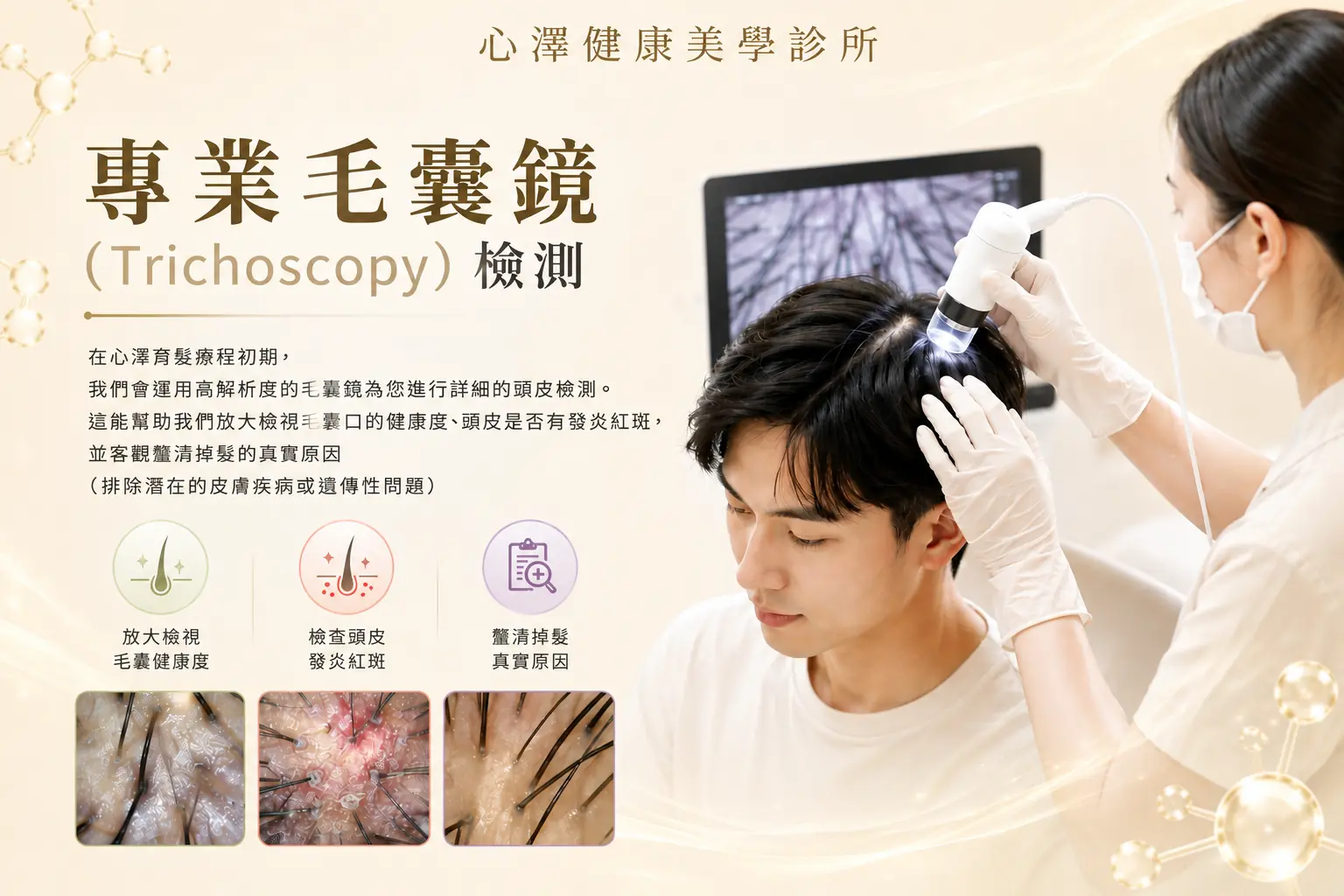 專業毛囊鏡 (Trichoscopy) 檢測