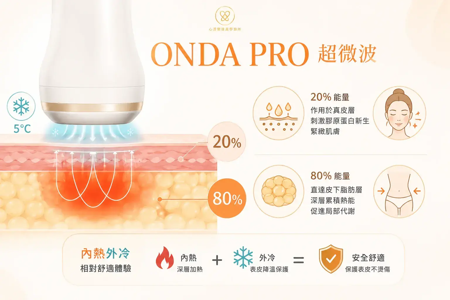 Onda Pro 超微波(溫和對抗局部囤積)