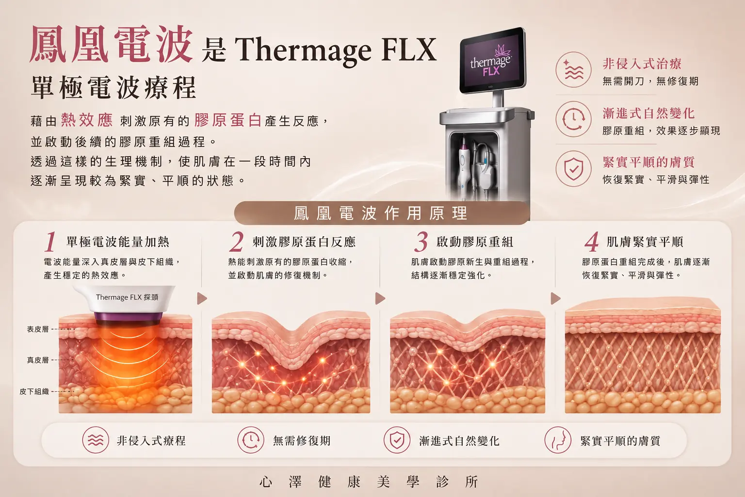 鳳凰電波 Thermage FLX