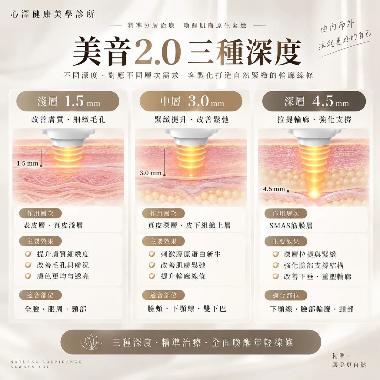 美國音波2.0三種深度：不同層次，如何搭配？