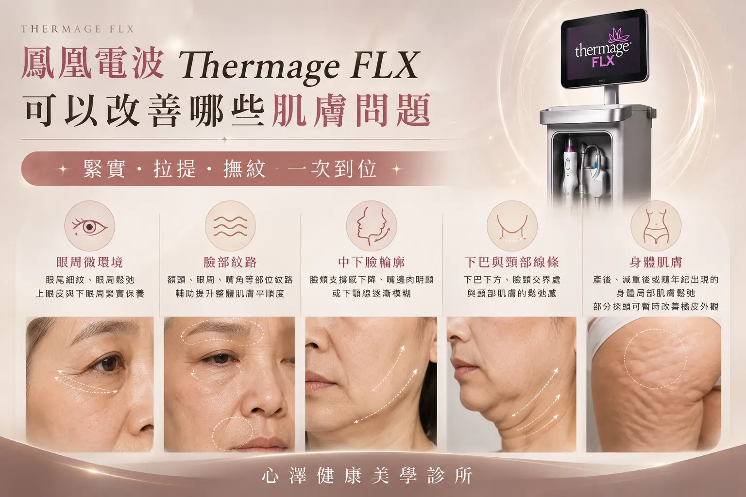 鳳凰電波 Thermage FLX可以改善哪些肌膚問題？