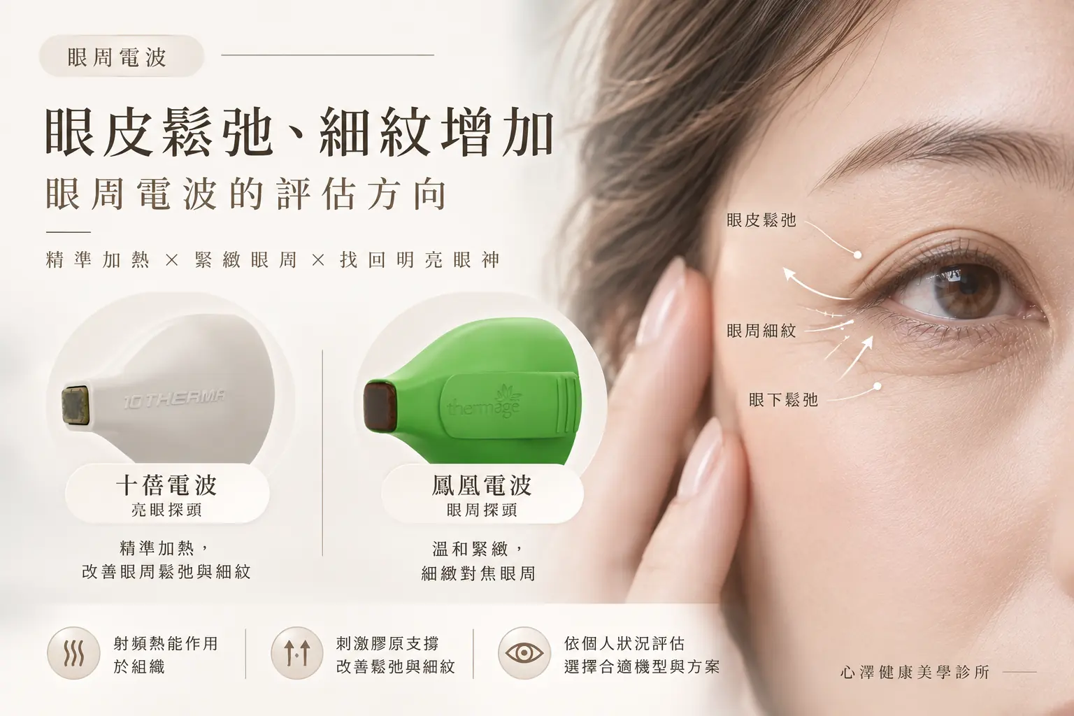 眼皮鬆弛、細紋增加：眼周電波的評估方向