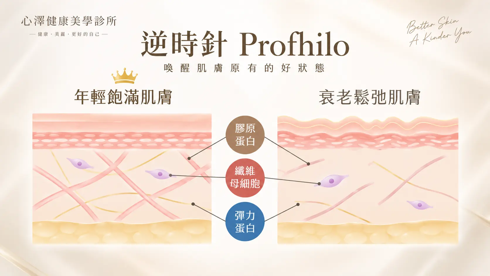 逆時針 Profhilo皮膚含水量、細紋、皺紋與彈性