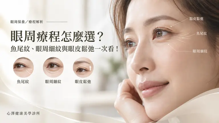眼周療程怎麼選？魚尾紋、眼周細紋與眼皮鬆弛一次看！