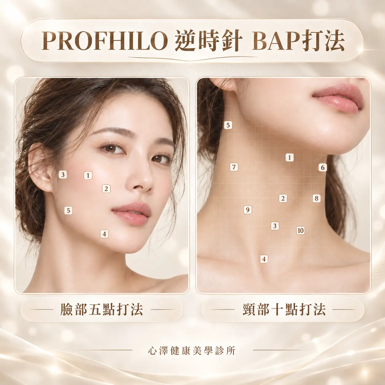 逆時針 ProfhiloBAP 五點注射