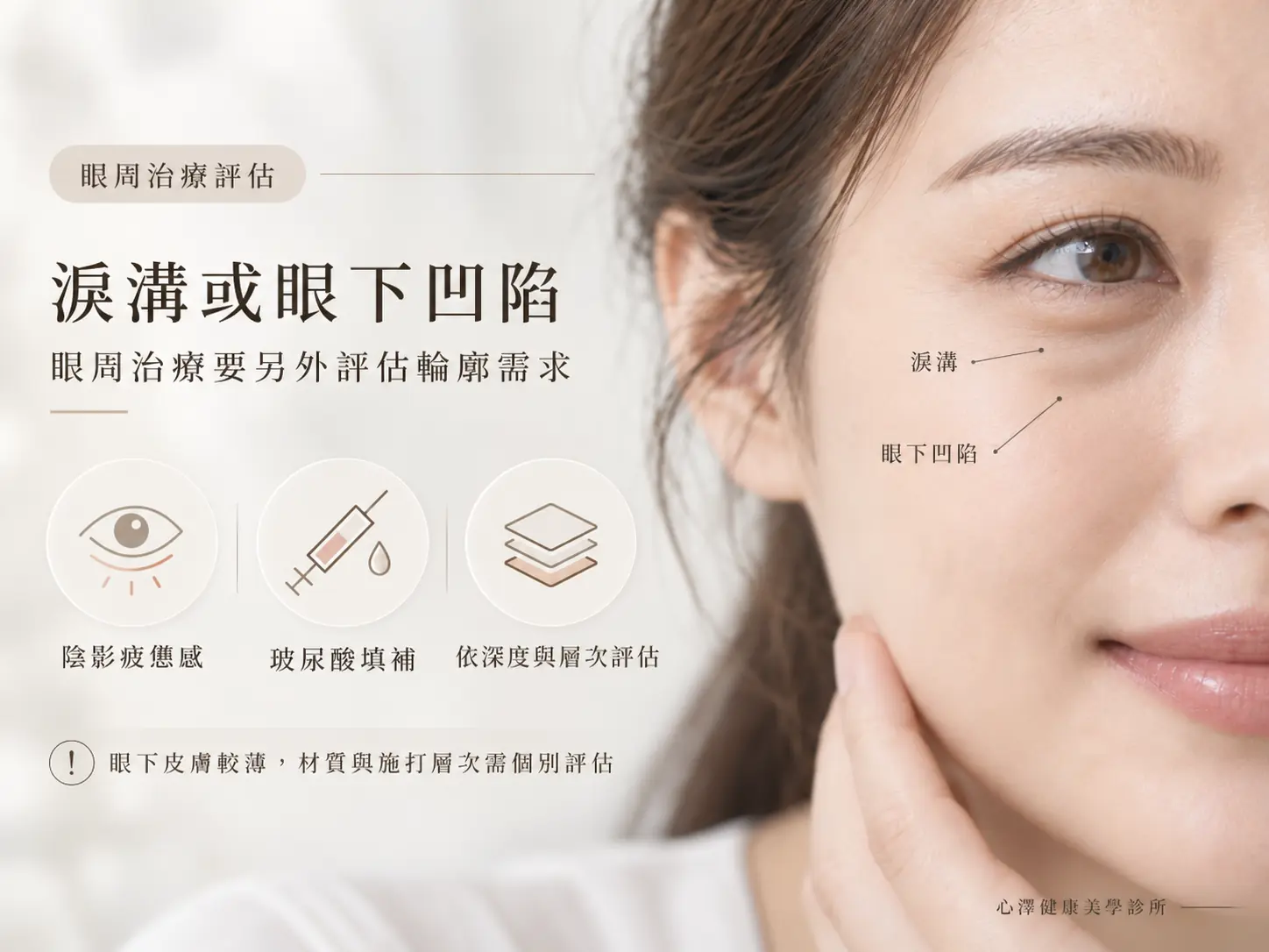 淚溝或眼下凹陷：眼周治療要另外評估輪廓需求